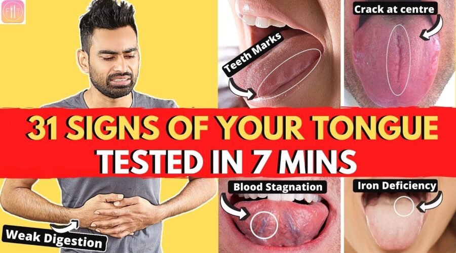 31 Tongue Signs Your Body is Asking for Help (With Solutions)