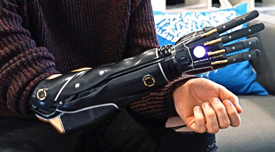 5 Futuristic Mind-Controlled Prosthetics